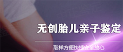 江苏怀孕了要如何办理亲子鉴定，江苏胎儿做亲子鉴定具体流程